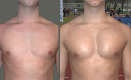 Ästhetische Chirurgie